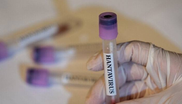 EMA: Hantavirüs için onaylı aşı veya tedavi bulunmuyor - Haberi Oku